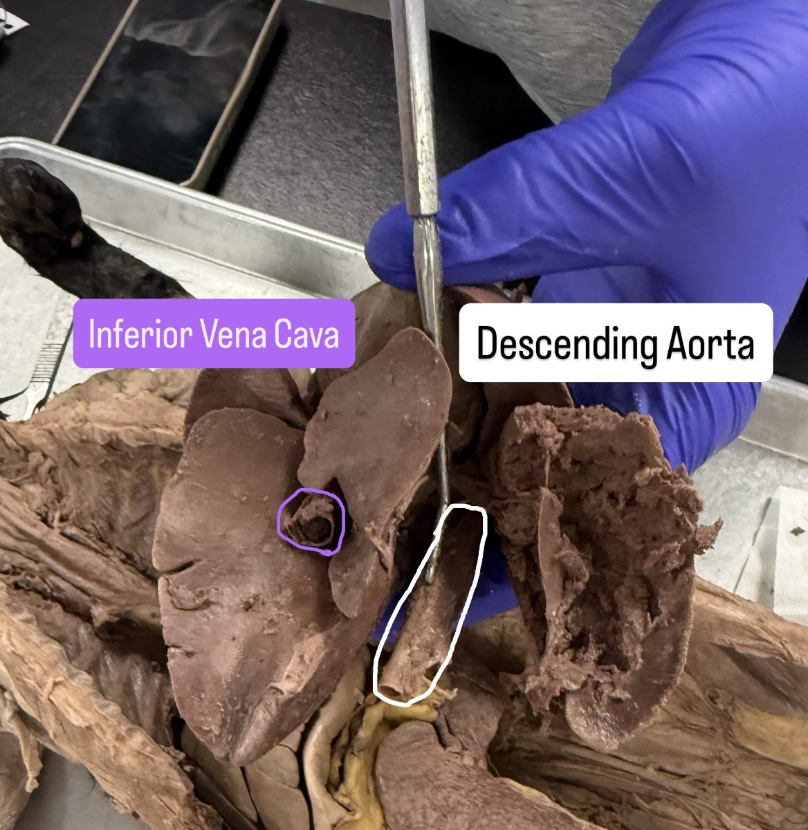 <p>Descending aorta, inferior vena cava</p>