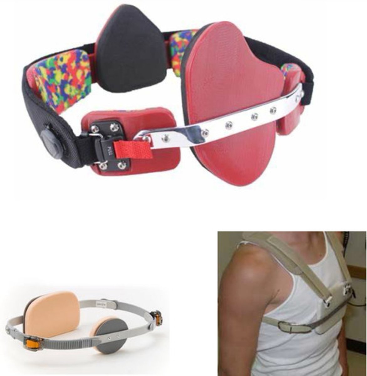 <p>used for pectus carinatum</p><p>pectus orthosis or "TO"</p><p>custom fit or custom fabricated</p><p>adjustable (accommodate deformity reduction)</p><p>goal: apply tolerable posteriorly-directed pressure to sternal protrusion</p>