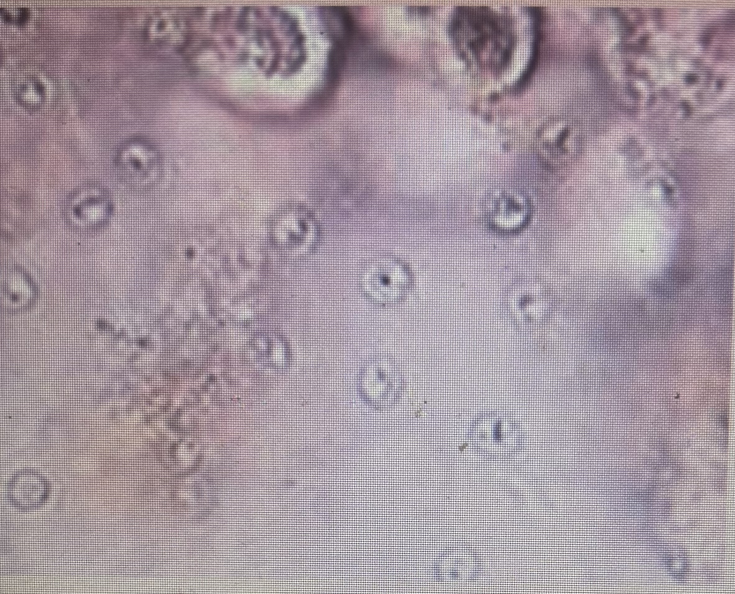 <p>Significant public health concern for humans </p><p>Causes frequent mucoid diarrhea</p><p>Size 4-6 um</p>