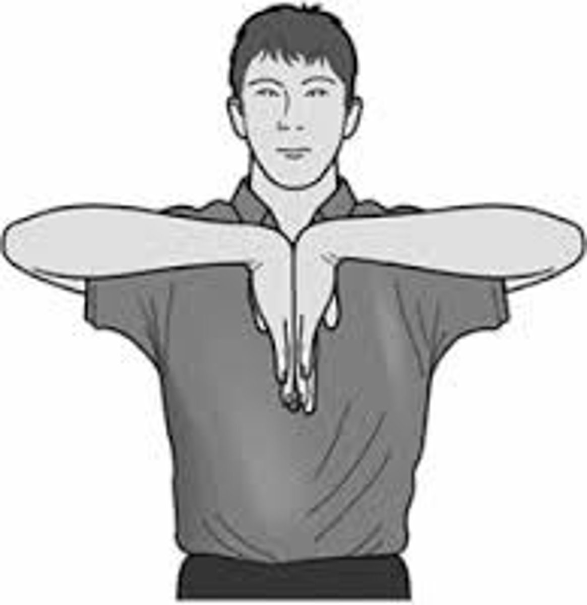 <p>Assesses median nerve for CTS; + test: paresthesia down median n distribution</p>