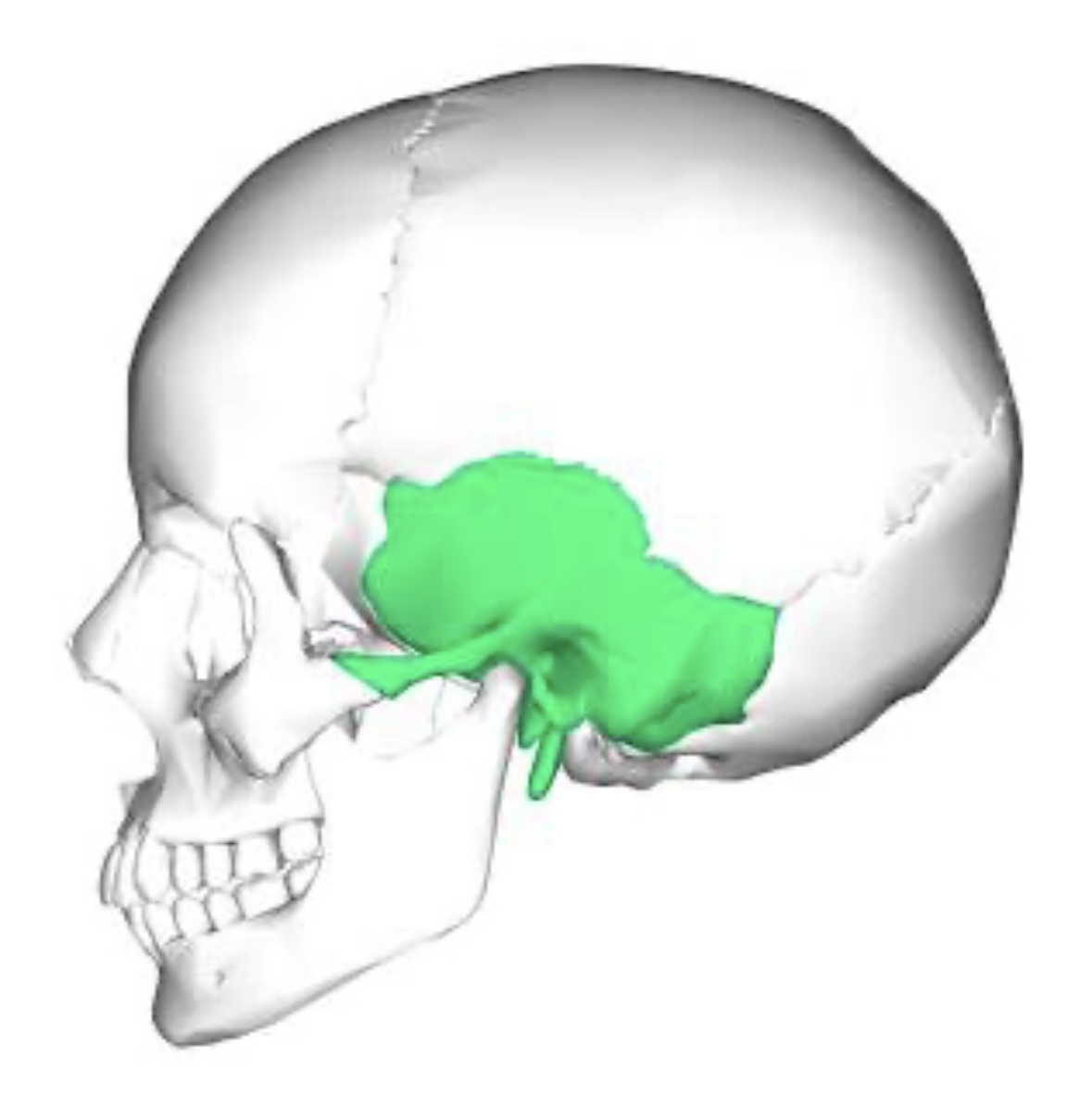 term image