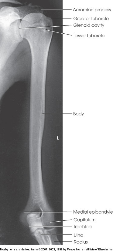 <p>What position is demonstrated?</p>