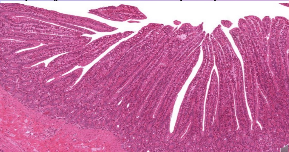 <p>Epitelio glandular exocrino tubular simple criptas de lieberkuhn</p>