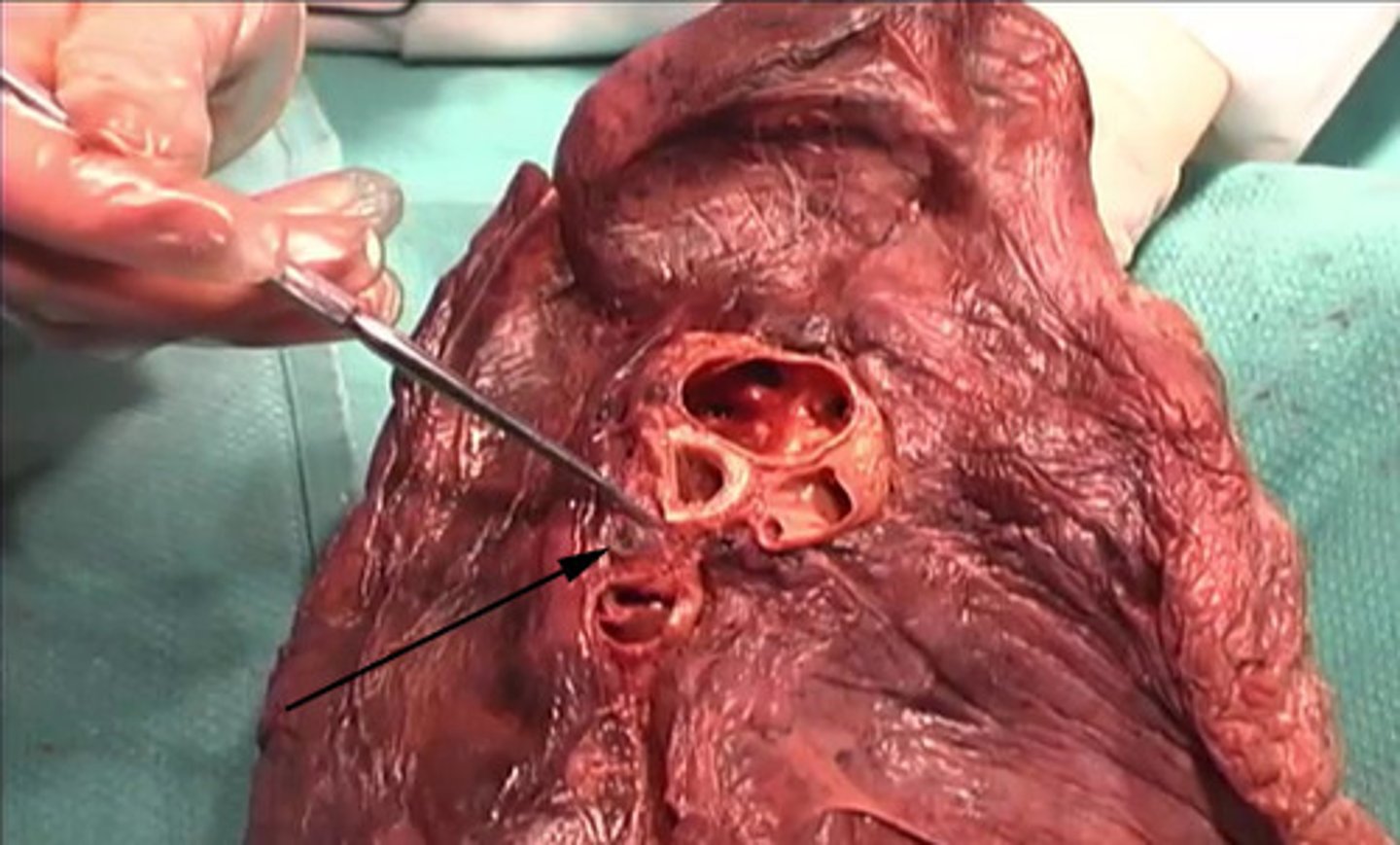 <p>To what structure is this arrow pointing?</p><p>Cervical Lymph Nodes</p><p>Axillary Lymph Nodes</p><p>Hilar Lymph Nodes</p><p>Mesenteric Lymph Node</p>