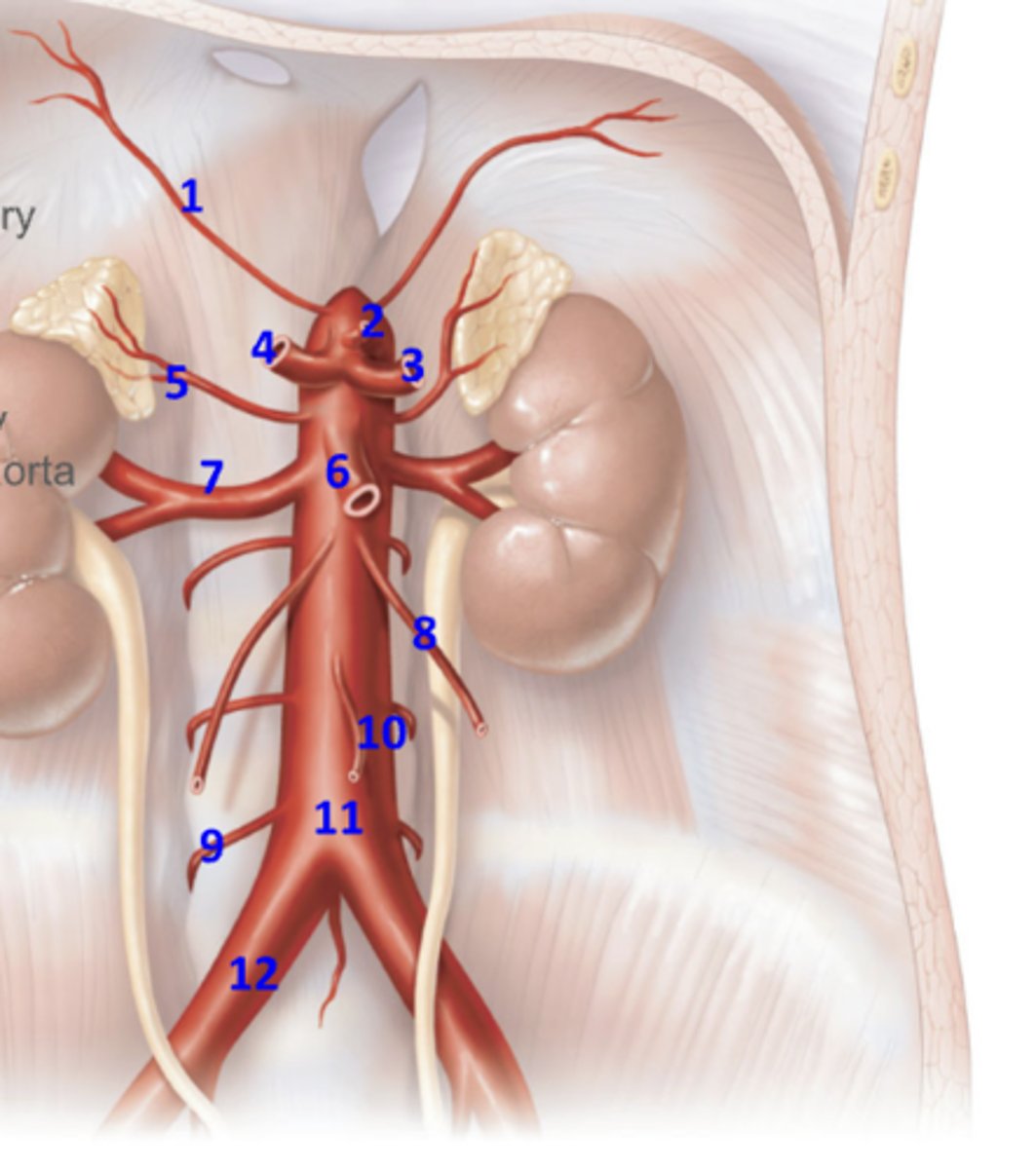 <p>What artery is 12?</p>