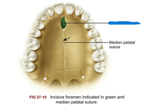 <p>What part of the skull is this?</p>