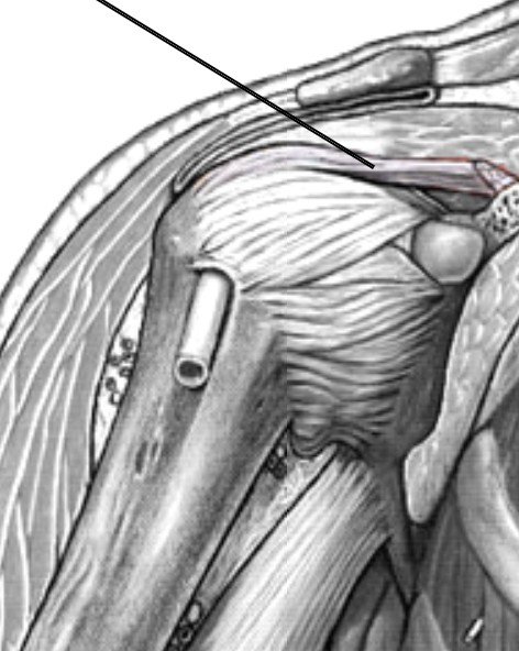 <p>Which ligament of the shoulder that connects between coracoid process and humerus?</p>