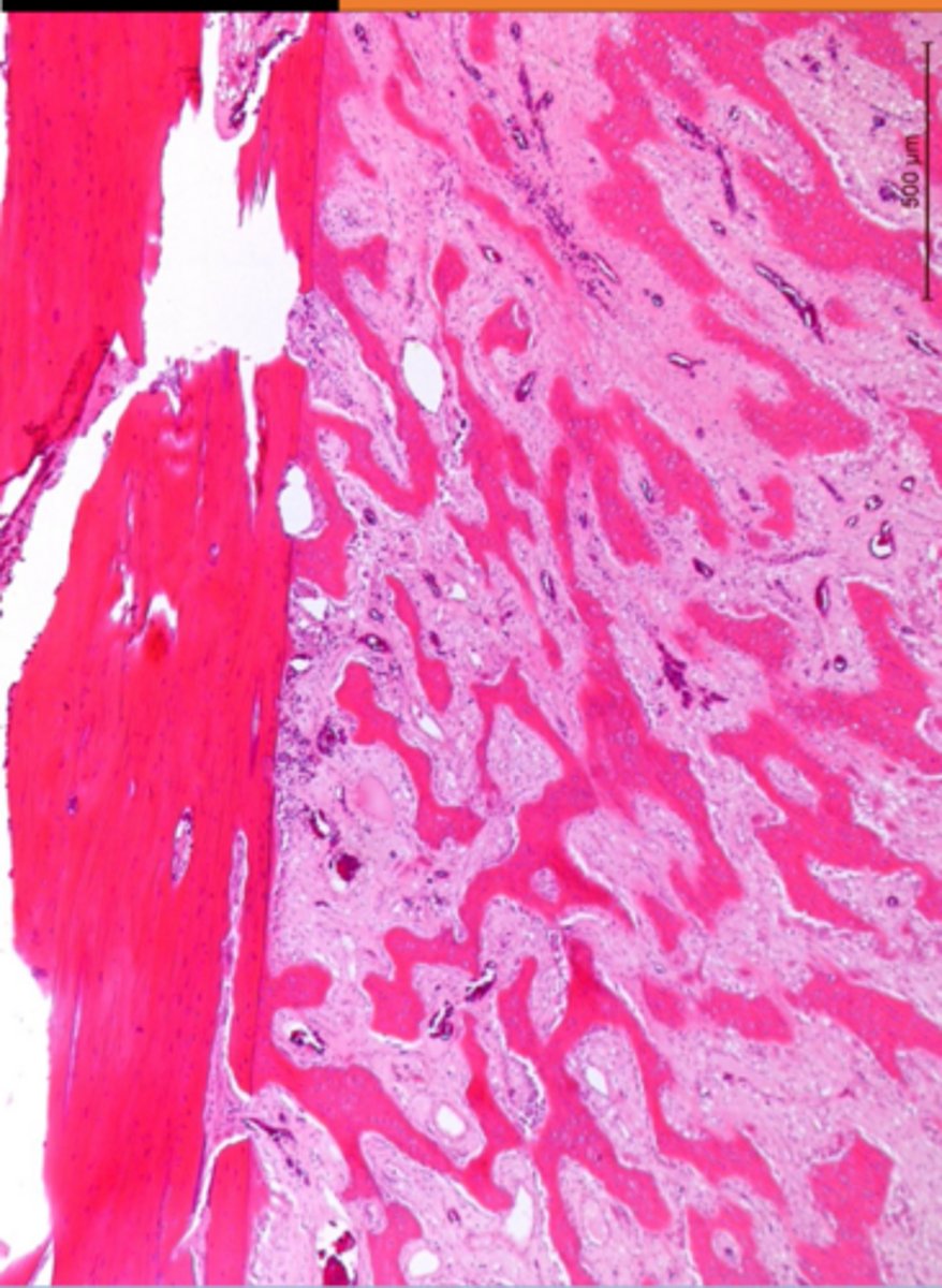 <p>Which side is the callus formation?</p>