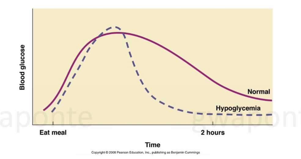 <ul><li><p>low blood sugar (glucose) </p></li><li><p>causes shakiness, sweating, anxiety </p></li><li><p>reactive hypoglycemia: pancreas secretes too much insulin after a high-carbohydrate meal </p></li></ul><p></p>