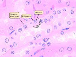 <p><span style="font-family: Arial; color: rgb(0, 0, 0)">Simple Cuboidal Epithelium</span><br><span style="font-family: Arial; color: rgb(0, 0, 0)">Function: Secretion and absorption</span><br><span style="font-family: Arial; color: rgb(0, 0, 0)">Found: Lining kidney tuboles, salvitory glands (mouth), bronchioles in lungs.</span></p><p></p>