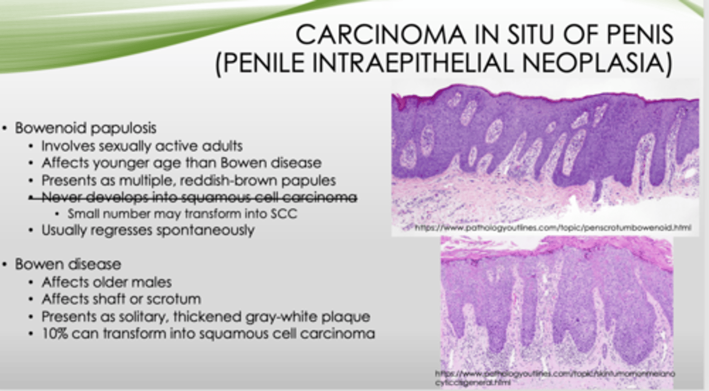 <p>Bowenoid</p>