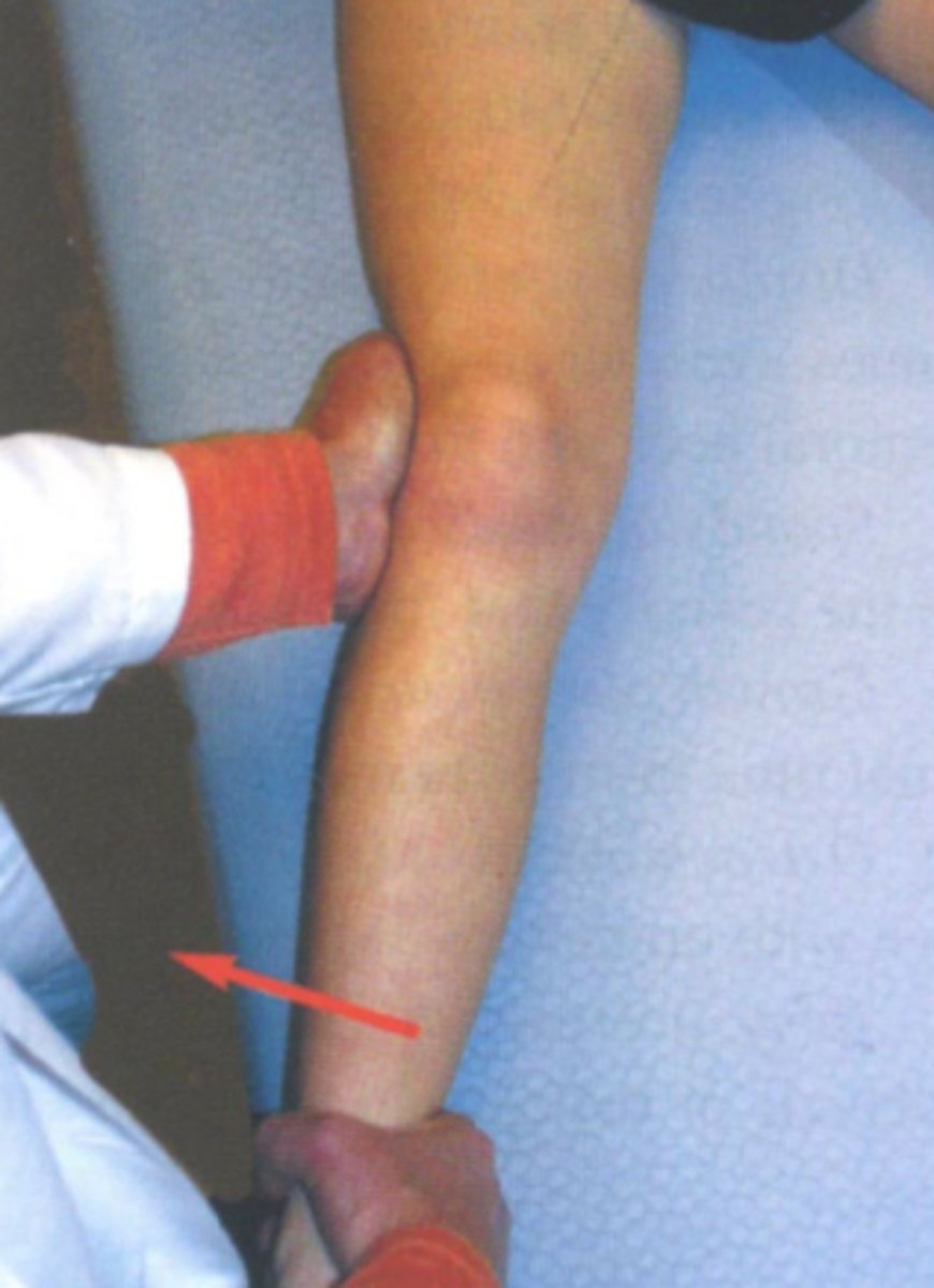 <p>- diagnosis: medial collateral ligament pathology</p><p>- how: apply valgus stress to both knees (once extended &amp; once in 30º of flexion)</p><p>+ = affected joint opens medially</p>