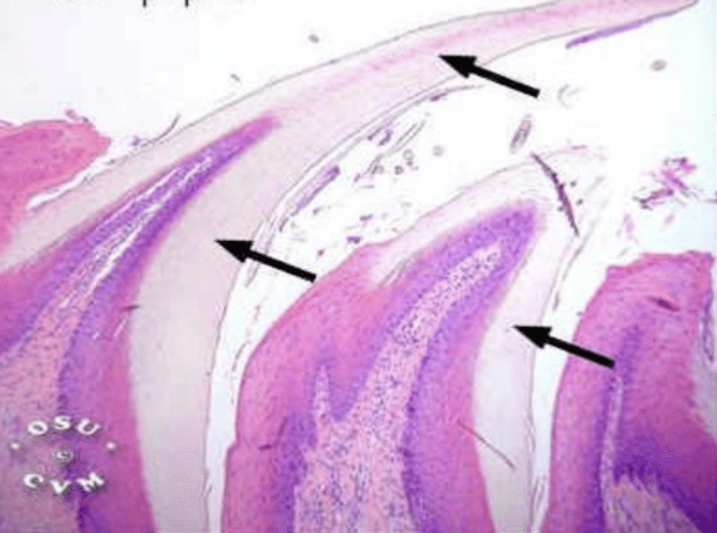 <p>what type of lingual papillae? why?</p>