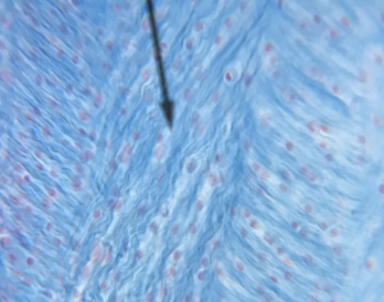 <p>what kind of cartilage is this</p>
