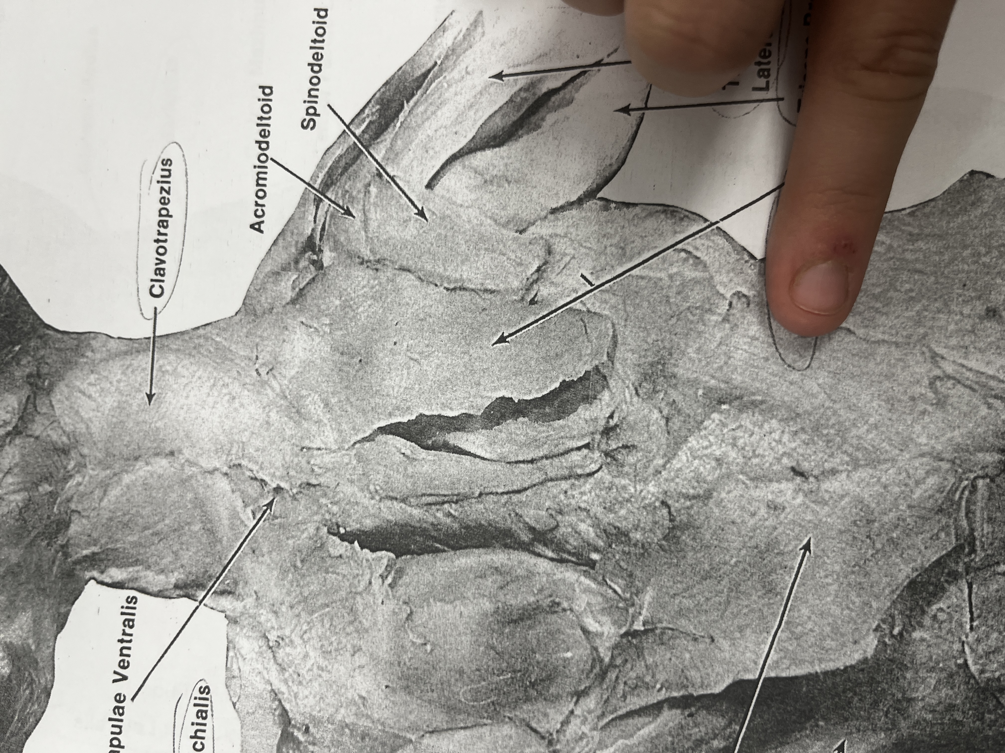 <p>A muscle in the shoulder that stabilizes and moves the scapula.</p>