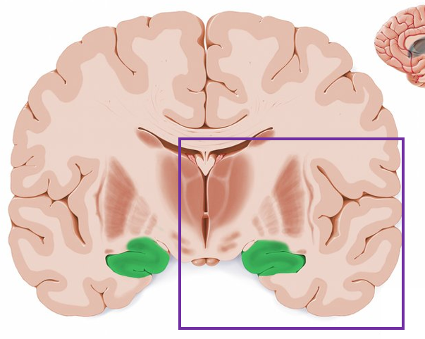 <p>what is highlighted in green?</p>