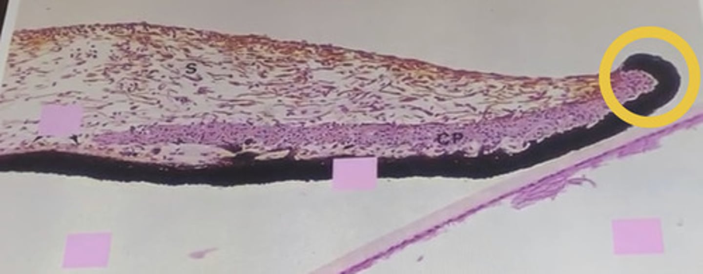 <p>wraps around the pupil margin to form the pupillary ruff</p>
