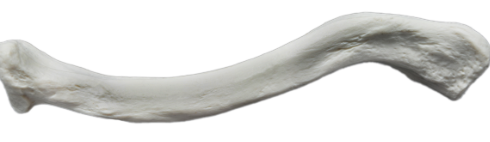 <p>What bone is this?</p>