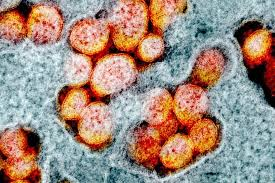 <p>What example of cell injury is this?</p>