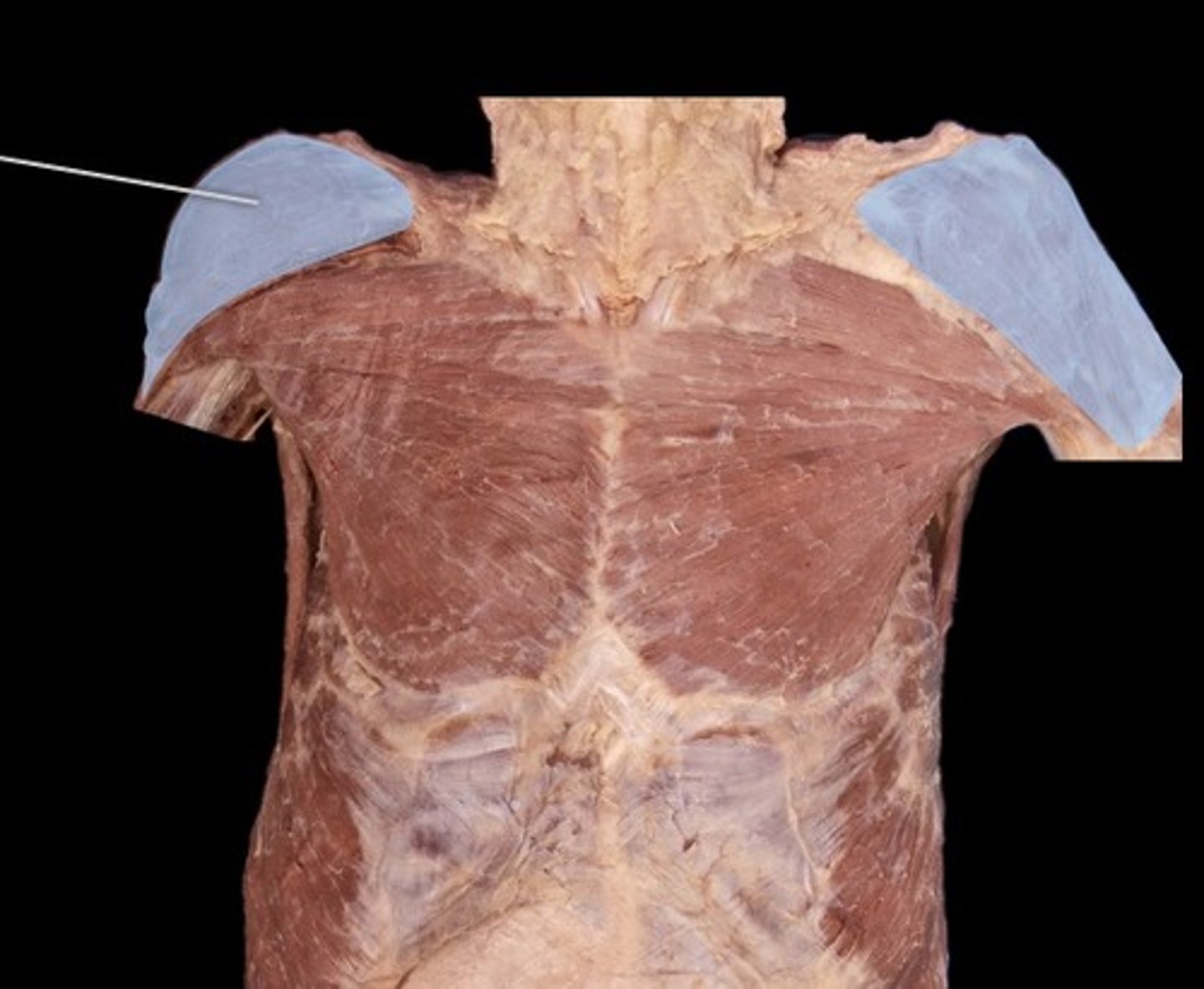 <p>What muscle is this?</p>