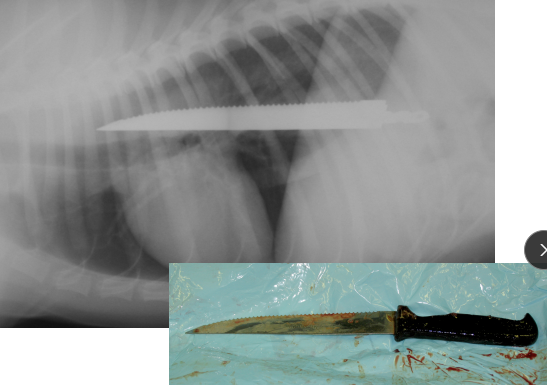 <ul><li><p><span style="background-color: transparent;"><strong><span>Et:</span></strong><span> located at cervical, thoracic inlet, base of heart, diaphragm</span></span></p></li><li><p><span style="background-color: transparent;"><strong><span>Sig:</span></strong><span> young</span></span></p></li><li><p><span style="background-color: transparent;"><strong><span>Cs: </span><u><span>acute regurg, dysphagia, gagging, salivation</span></u></strong></span></p></li><li><p><span style="background-color: transparent;"><strong><span>Dt:</span></strong><span> rads, endoscopy</span></span></p></li><li><p><span style="background-color: transparent;"><strong><span>Tx:</span></strong><span> </span><strong><span>u</span></strong></span><span style="background-color: transparent; color: green;"><strong><span>rgent endoscopic removal</span></strong><span> or surgery </span></span></p></li><li><p><span style="background-color: transparent;"><strong><span>Comp: </span></strong></span><span style="background-color: transparent; color: green;"><span>perforation, esophagitis, stricture, aspiration pneumonia</span></span></p></li></ul><p></p>