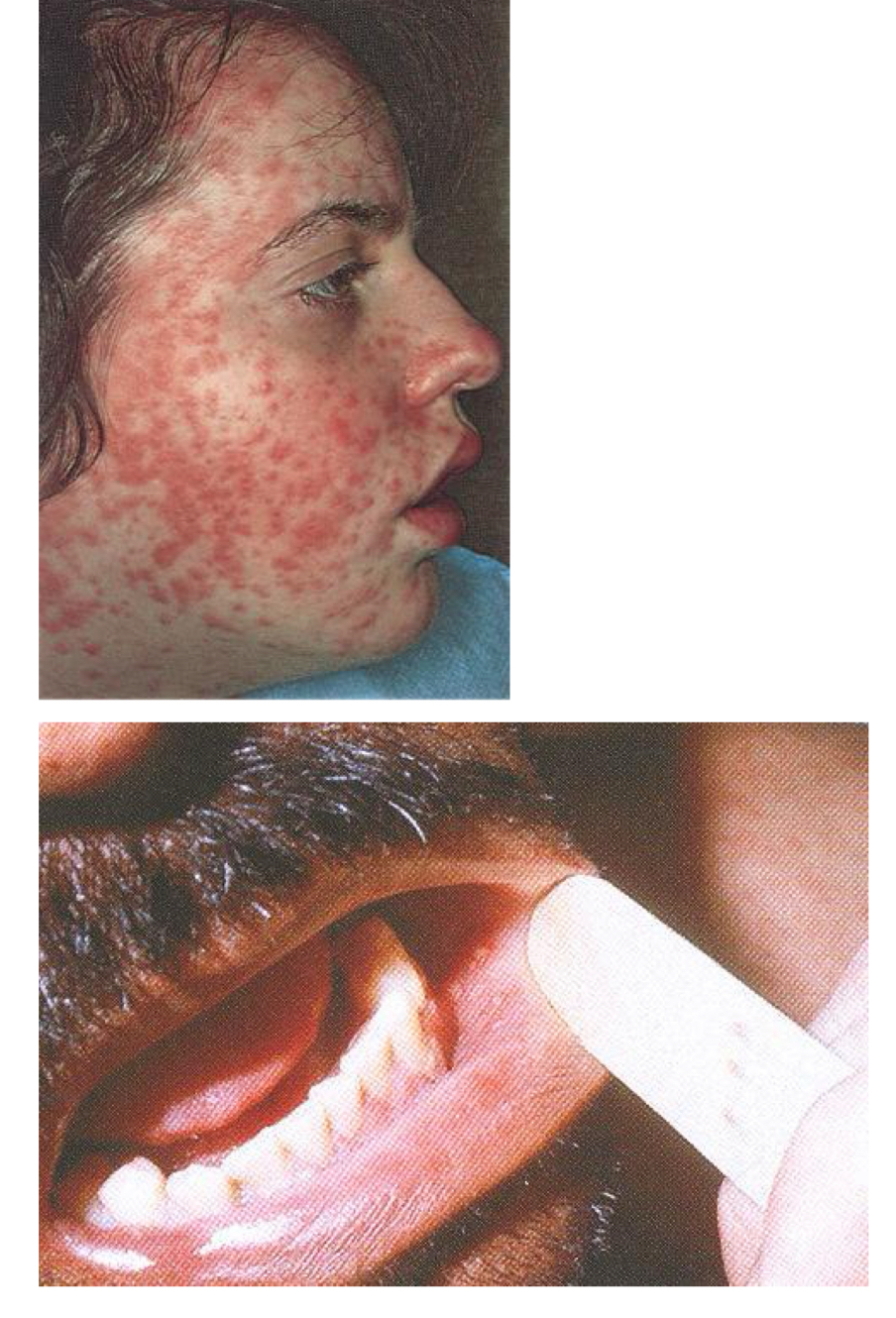 <p>what infection is this? </p>