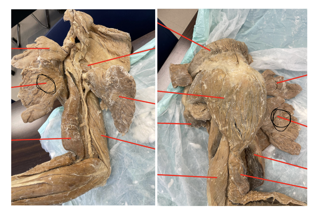 <p>what muscle do the marked images represent?</p>