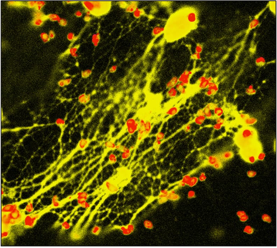 <p>Neutrophil extracellular traps spew DNA nets that trap and kill microbes</p><p>the neutrophil dies after</p>