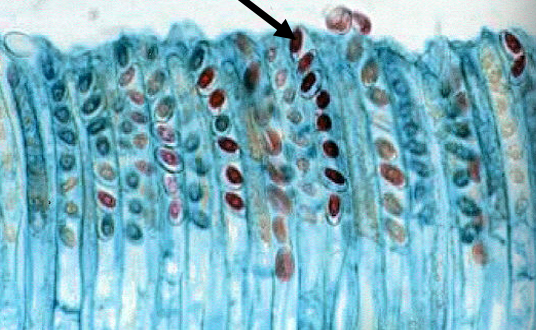 <p>what is this? what genus + fungi type is it?<br>what is the arrow pointing to?</p>