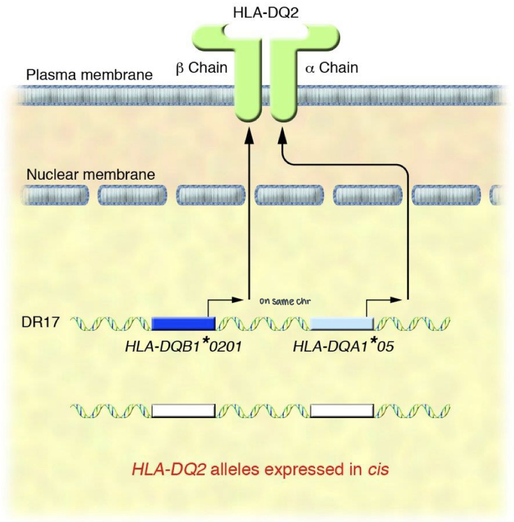 celiac disease
