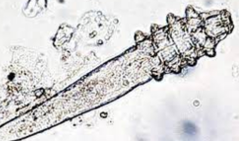 <p>What mite is this and where would you find it?</p>