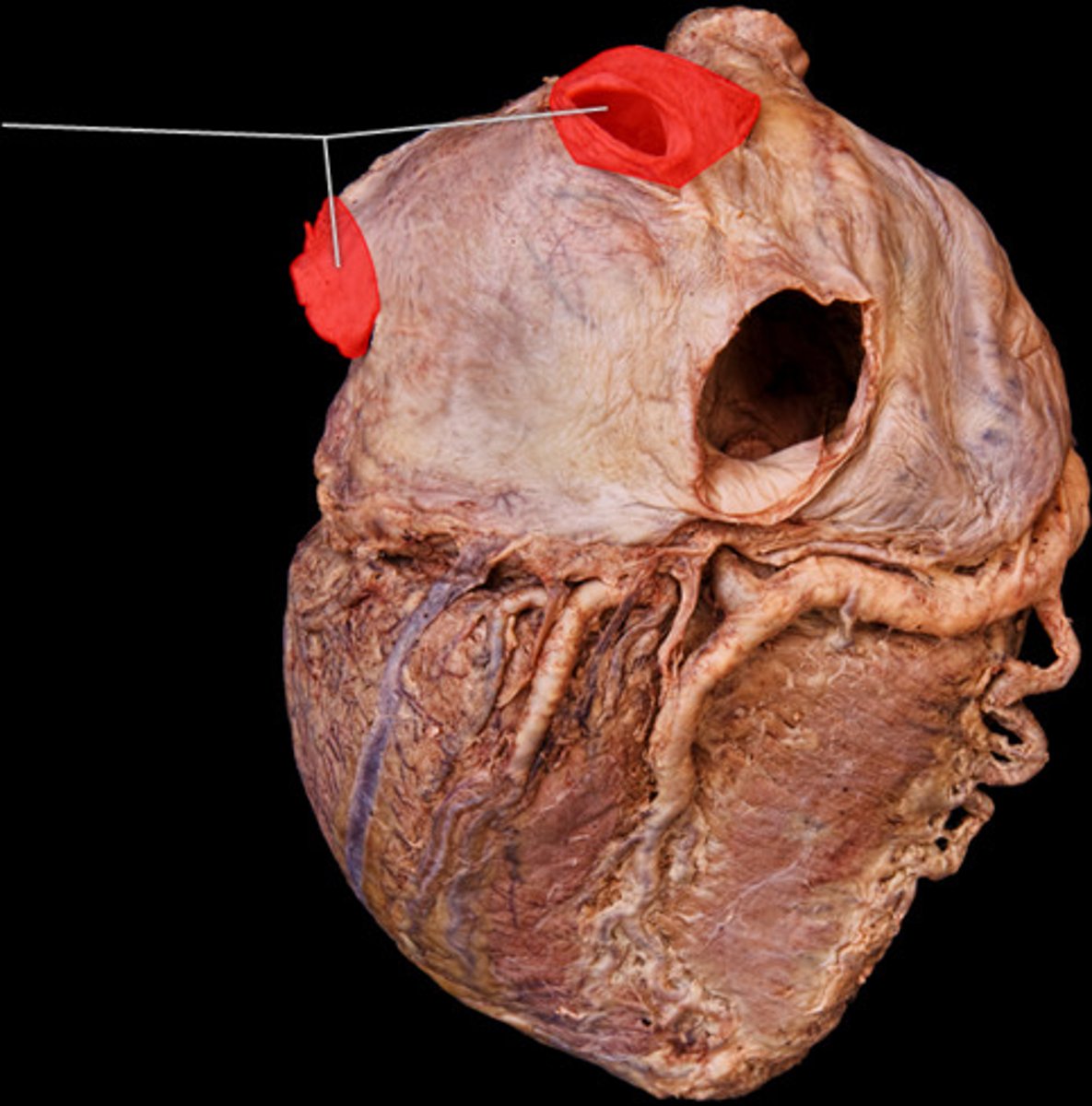 knowt flashcard image