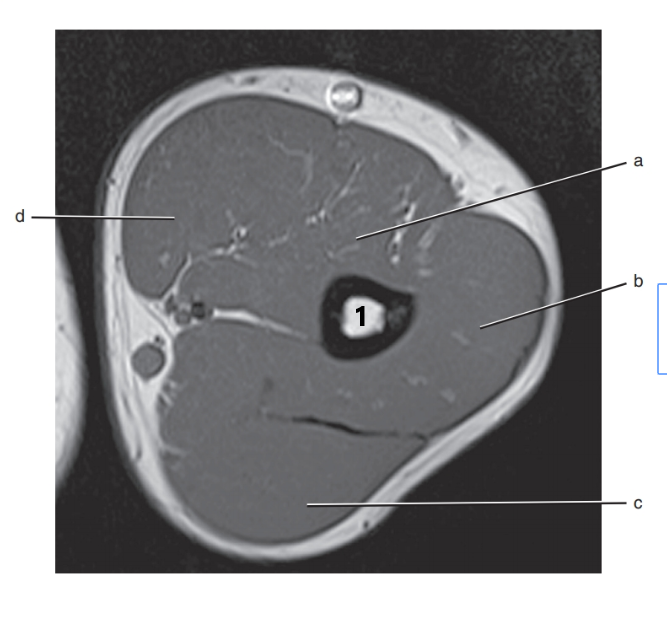 <p>What is # 1 ?</p>