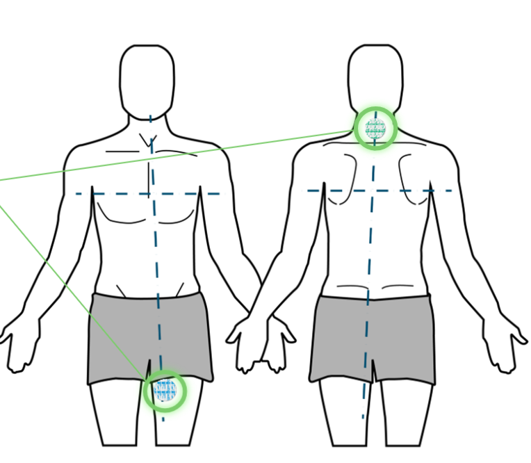 <ol start="2"><li><p>Neck: below the crease of the neck, midline</p></li><li><p>Left Leg: inner thigh</p></li></ol><p></p>