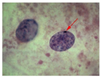 <p>Stained interphase cells</p>