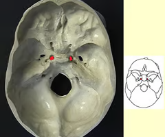<p>passageway for internal carotid artery </p>