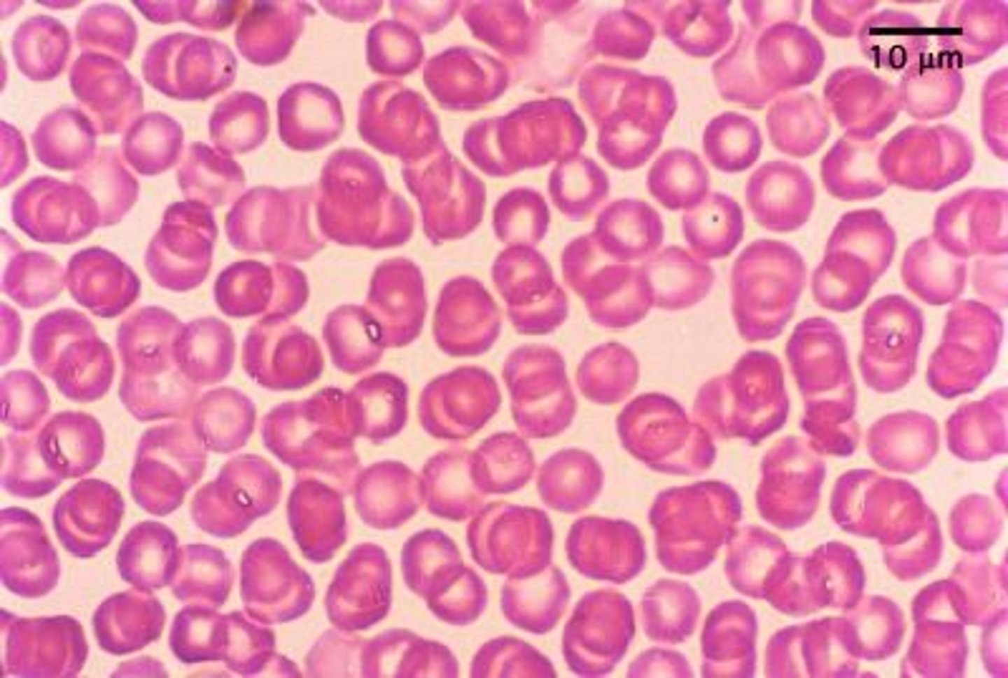 <p>RBC range</p><p>Hct range</p><p>Hb range</p>