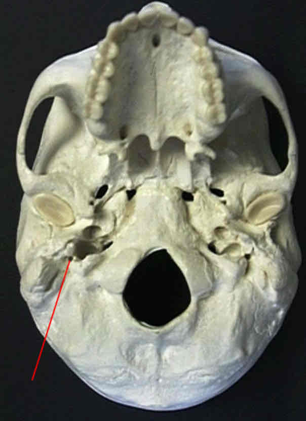 <p>What cranial nerve is indicated?</p>