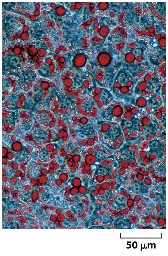 <p>Fat </p>