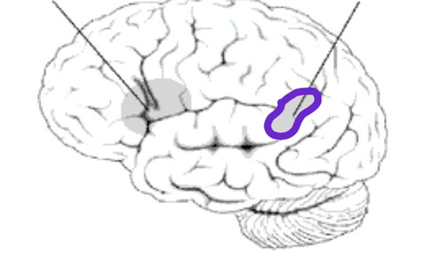 <p>- Located in posterior end of the superior temporal gyrus</p><p>- Speech sound comprehension</p>