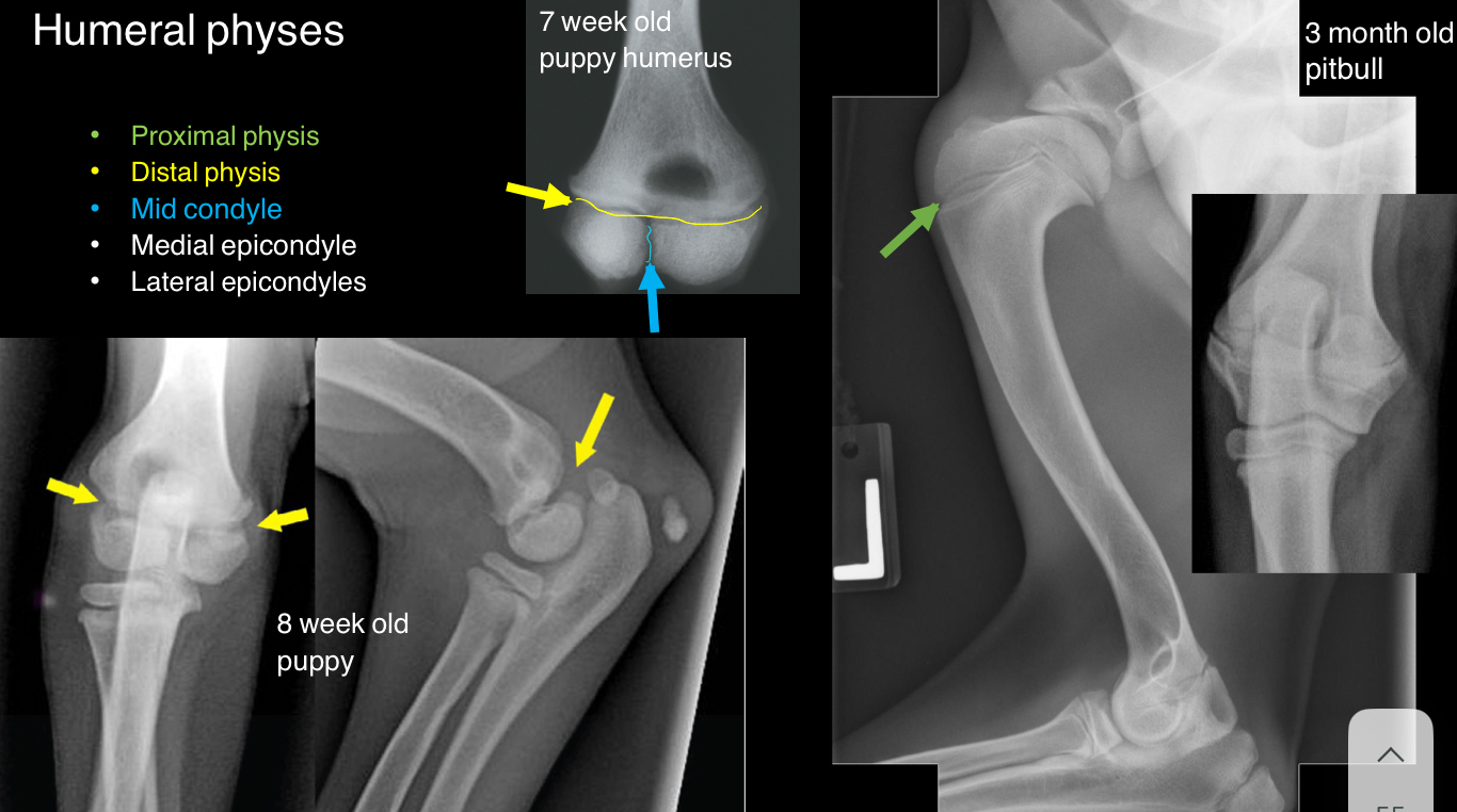 <ul><li><p>proximal</p></li><li><p>Distal</p></li><li><p>Mid-condyle</p></li><li><p>Medial epicondyle</p></li><li><p>Lateral epicondyle</p></li></ul>