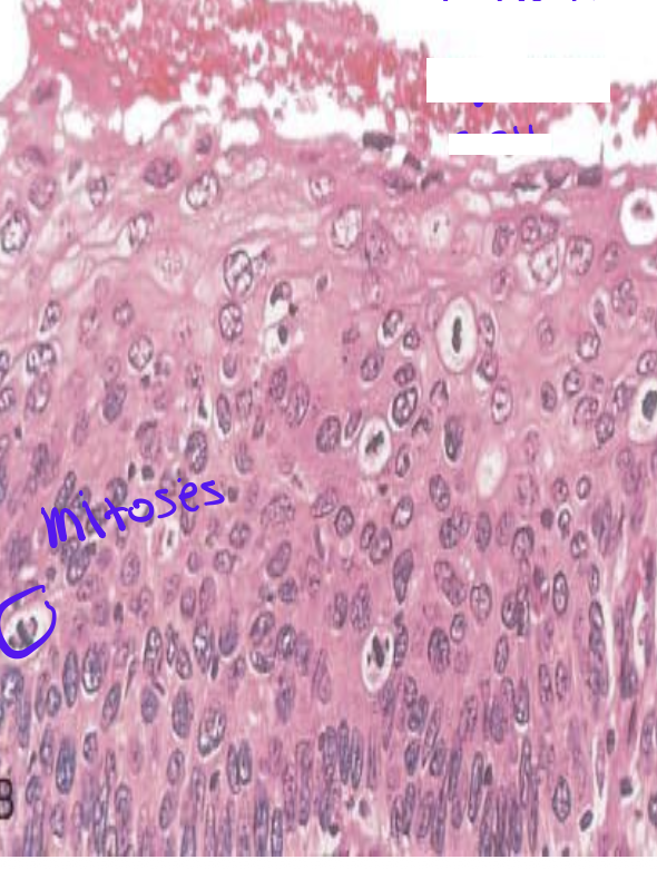 <p>Identify the <strong>organ</strong> and the <strong>diagnosis</strong> in this format: <em>diagnosis, organ</em></p>