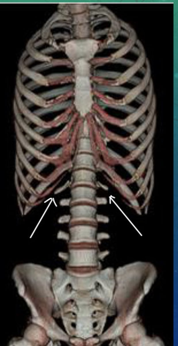 <p>What anomaly do we see here?</p>