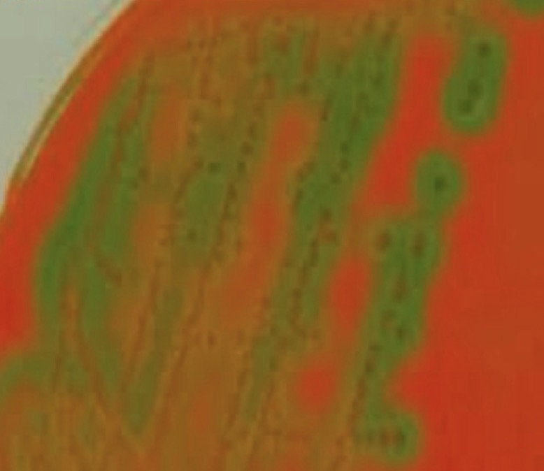 <p>A- identify</p><p>B- Identify this media</p><p>C- Morphological features seen</p><p>D- Give example</p><p>E- features under microscope</p><p>F- biochemical reaction</p>