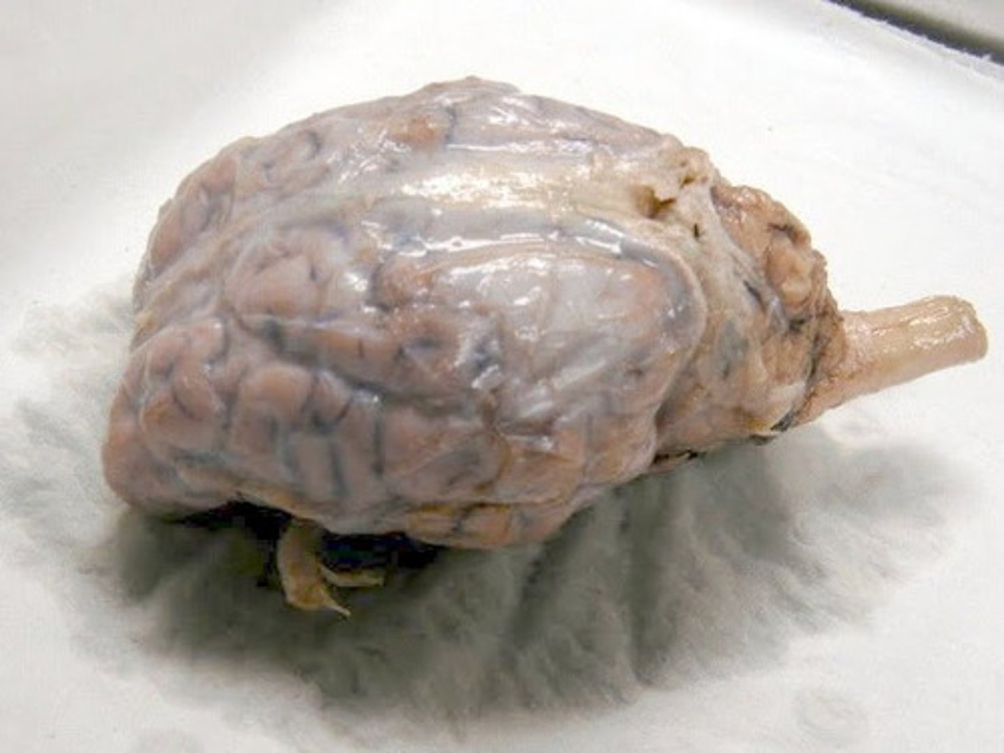 <p>dura mater</p>
