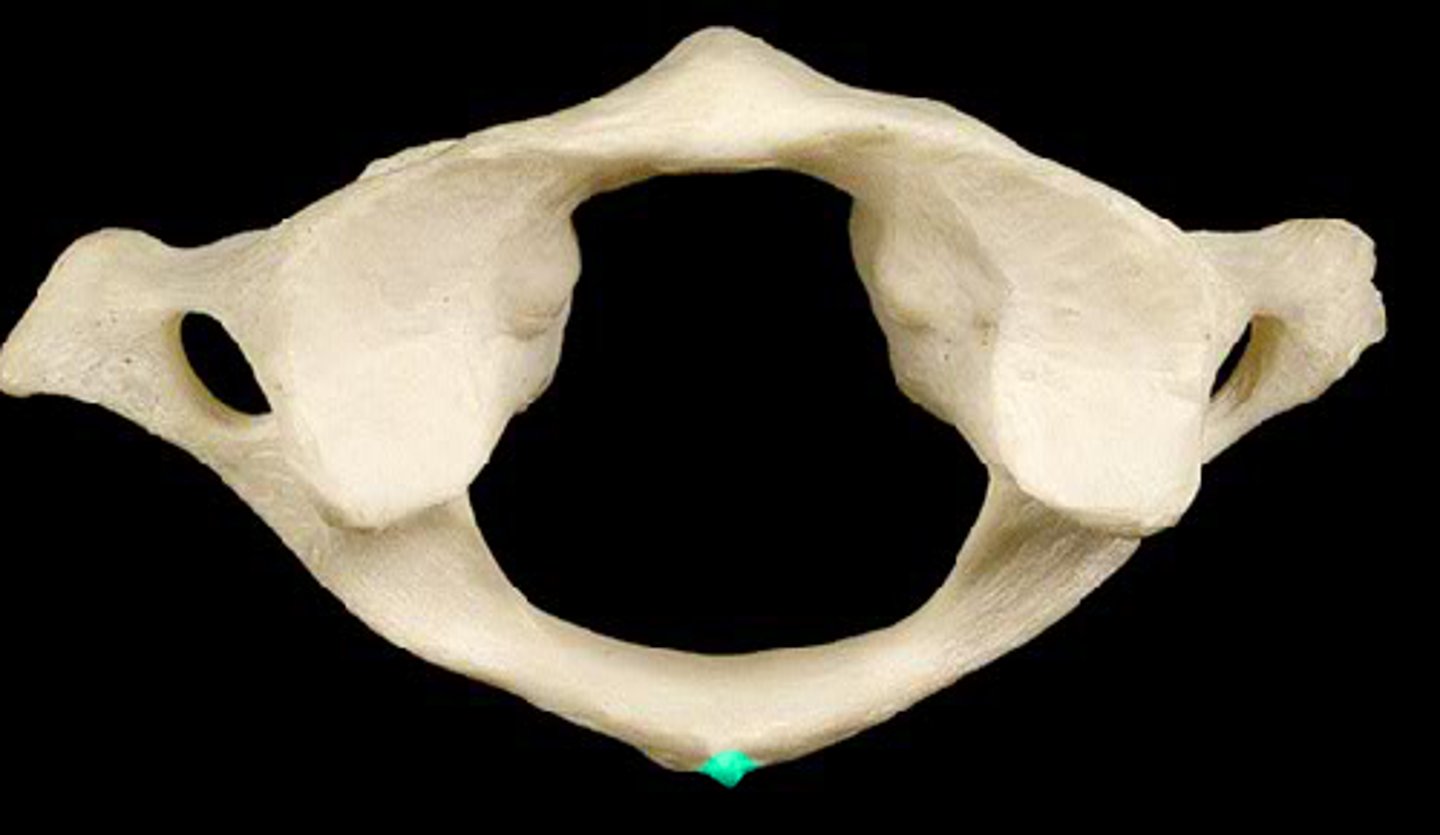 <p>Where nuchal ligament attaches</p>