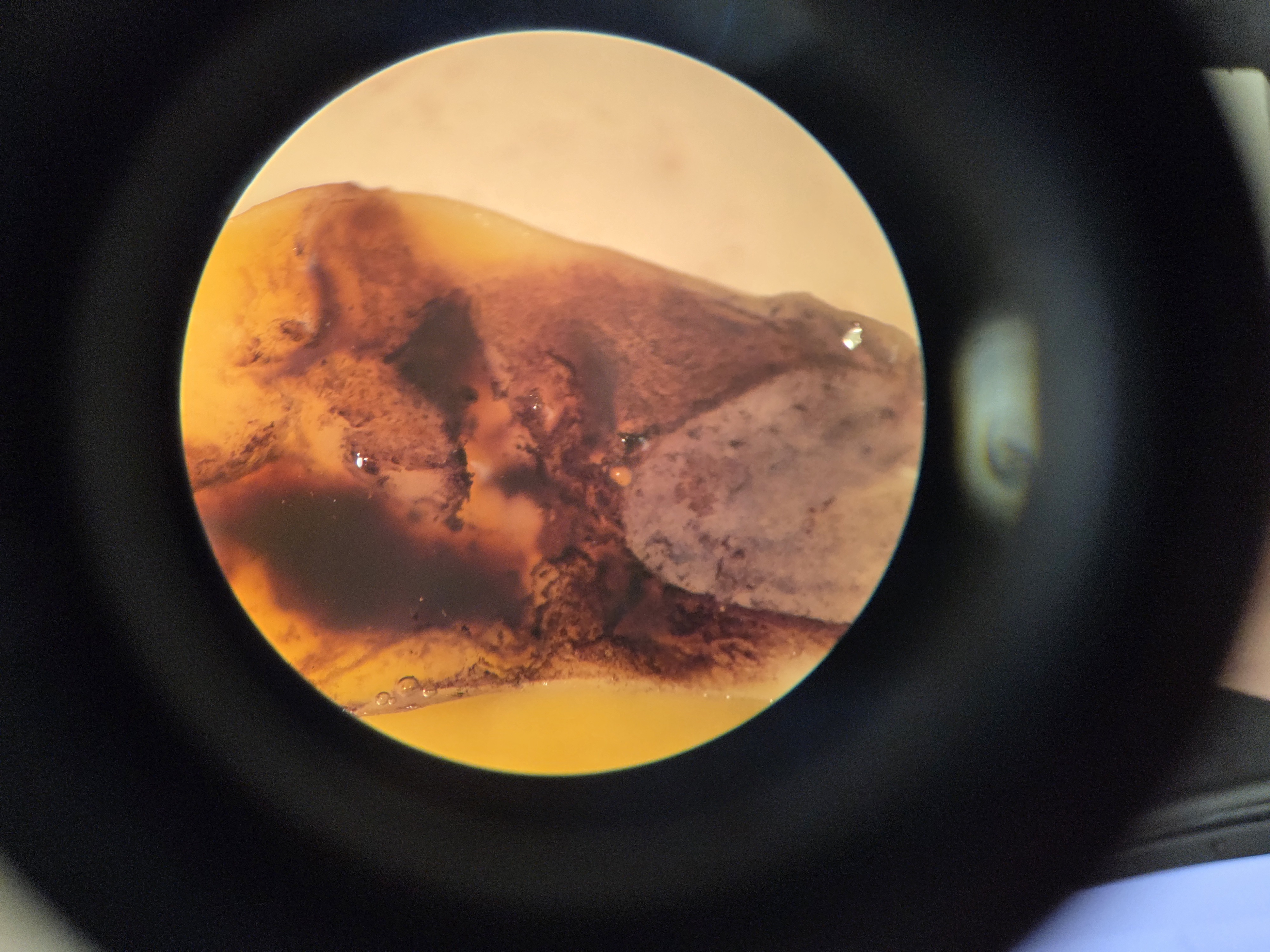 <p>When stained with iodine, what is being shown?</p>