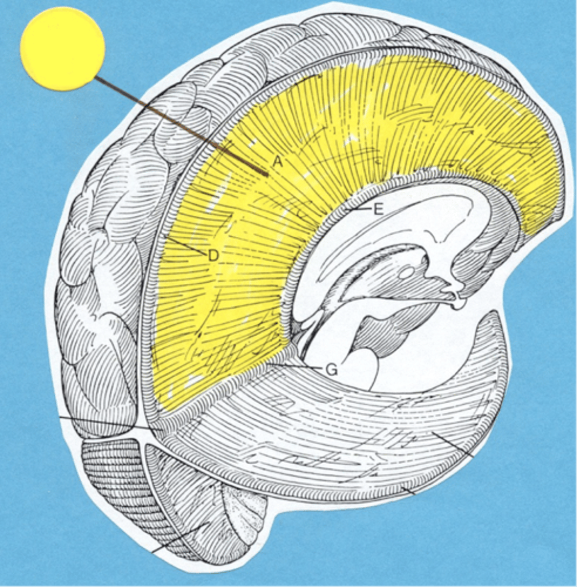 <p>Between the 2 cerebral hemispheres</p>