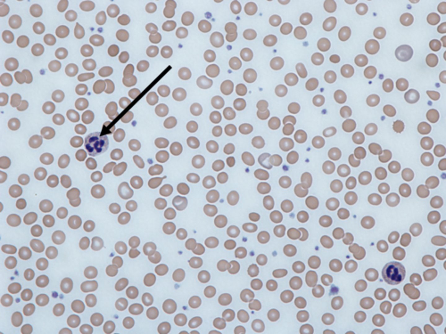 <p>White blood cells</p>