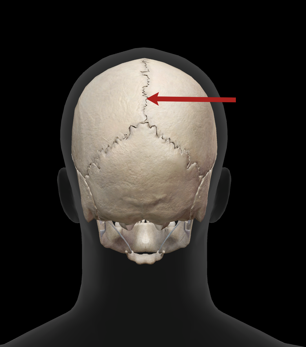 <p>What is the name of this suture?</p>